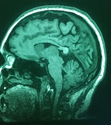 decision making model